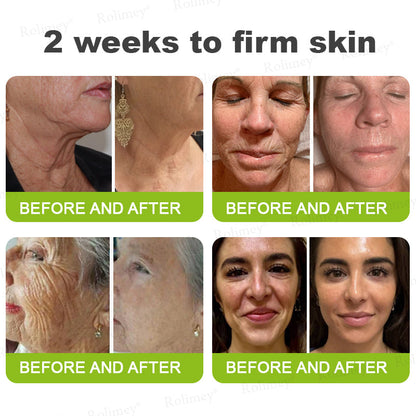 💫💧⭐Made and shipped from the USA 💫Rolimey® Botox & Vita-A Retinol Shot Wrinkle-Lift Tightening cream - Last Day Promotion 70% OFF