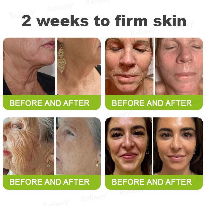 ✨🌿Made and Shipped from the USA ✅Rolimey® Botox & Vita-A Retinol Shot Wrinkle-Lift Tightening stick- Last Day Promotion 70% OFF🔥LAST DAY 70% OFF