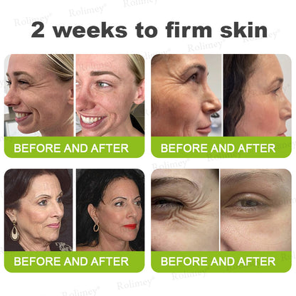 💫💧⭐Made and shipped from the USA 💫Rolimey® Botox & Vita-A Retinol Shot Wrinkle-Lift Tightening cream - Last Day Promotion 70% OFF