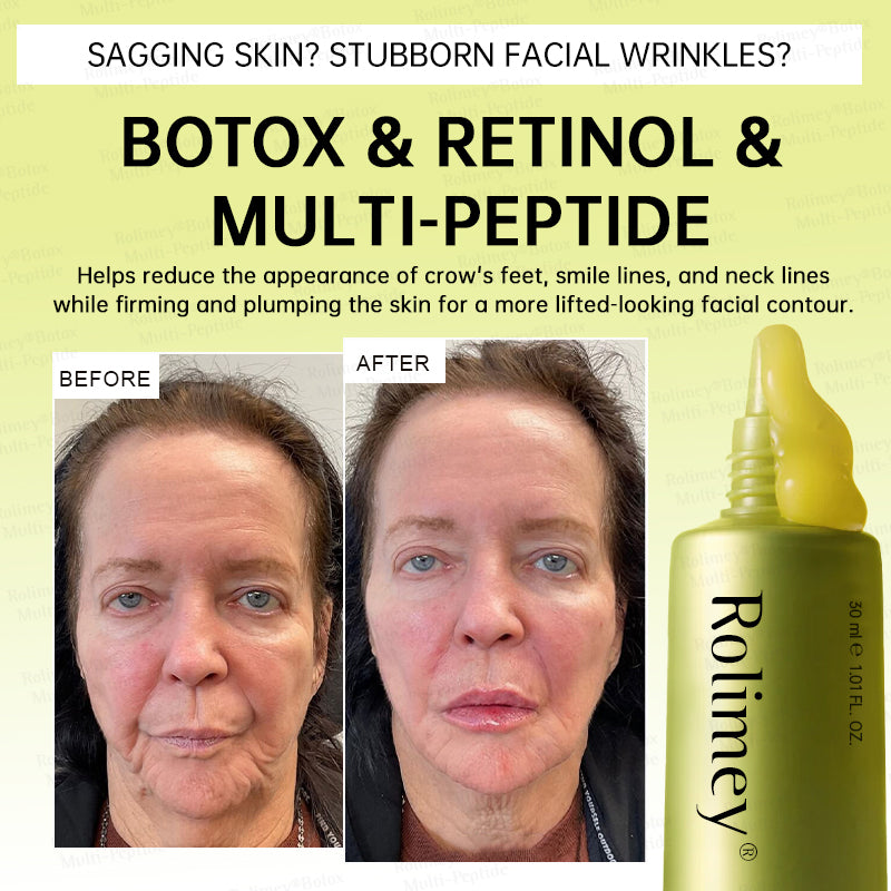 💐🌿🌟Rolimey® Multi-Peptide Retinol Shot Wrinkle-Lift Cream