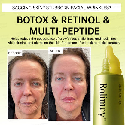💐🌿🌟Rolimey® Multi-Peptide Retinol Shot Wrinkle-Lift Cream