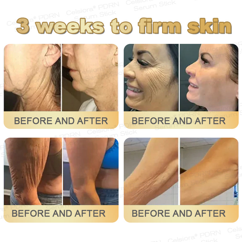 🎁✨Celsiora® Firming Serum Stick👩‍🔬LAST DAY 70% OFF