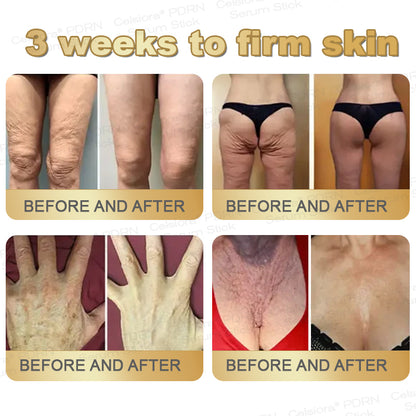 🎁✨Celsiora® Firming Serum Stick👩‍🔬LAST DAY 70% OFF
