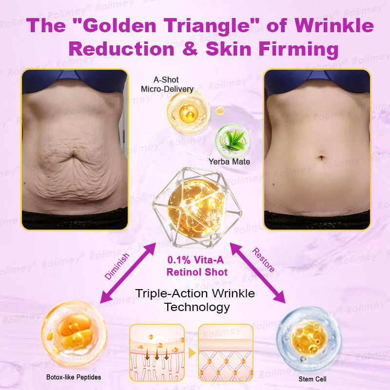 🌟Made and shipped from the USA 🌟Rolimey® Botox Stem Cell Retinol Wrinkle-Lift Cream - Visibly Lift & Smooth Neck and Chest Wrinkles