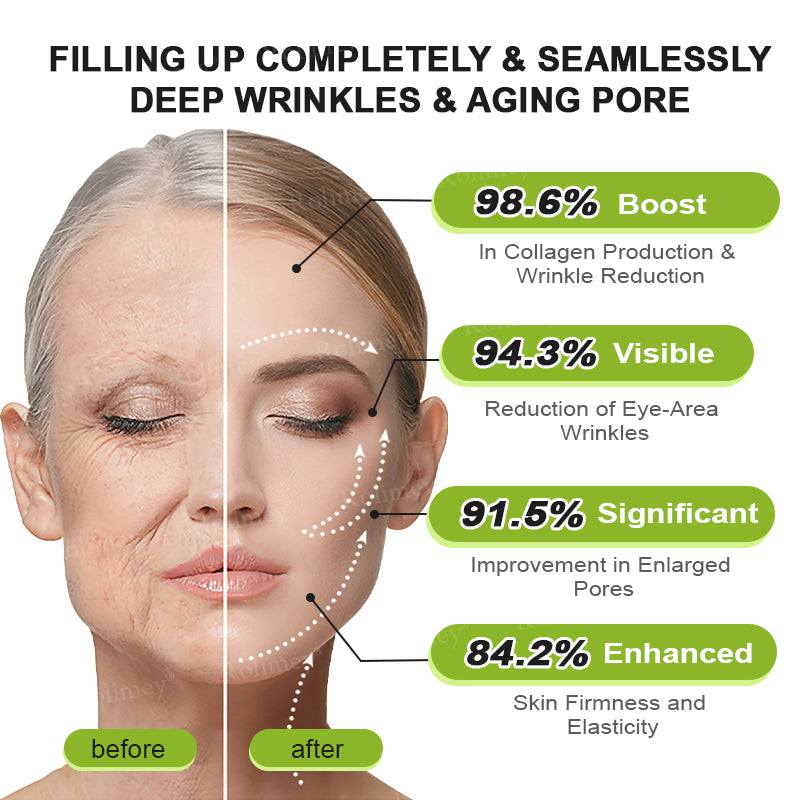 💫💧⭐Made and shipped from the USA 💫Rolimey® Botox & Vita-A Retinol Shot Wrinkle-Lift Tightening cream - Last Day Promotion 70% OFF