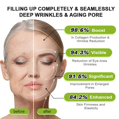 ✨🌿Made and Shipped from the USA ✅Rolimey® Botox & Vita-A Retinol Shot Wrinkle-Lift Tightening stick- Last Day Promotion 70% OFF🔥LAST DAY 70% OFF