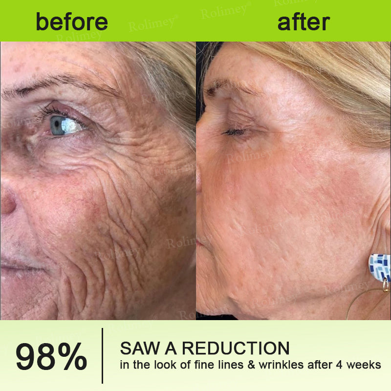 💫💧⭐Made and shipped from the USA 💫Rolimey® Botox & Vita-A Retinol Shot Wrinkle-Lift Tightening cream - Last Day Promotion 70% OFF