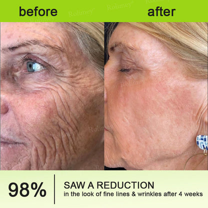 💫💧⭐Made and shipped from the USA 💫Rolimey® Botox & Vita-A Retinol Shot Wrinkle-Lift Tightening cream - Last Day Promotion 70% OFF