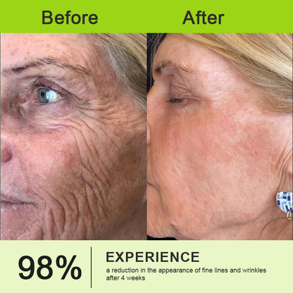 ✨🌿Made and Shipped from the USA ✅Rolimey® Botox & Vita-A Retinol Shot Wrinkle-Lift Tightening stick- Last Day Promotion 70% OFF🔥LAST DAY 70% OFF