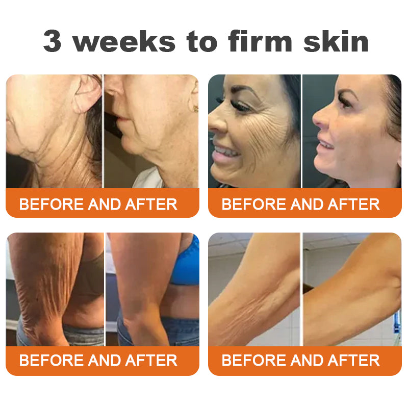💙💎✨Made and Shipped from USA✨Flysmus™ Botox Bee Venom Firming Serum Stick👩‍🔬LAST DAY 70% OFF