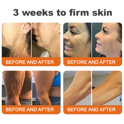 💙💎✨Made and Shipped from USA✨Flysmus™ Botox Bee Venom Firming Serum Stick👩‍🔬LAST DAY 70% OFF