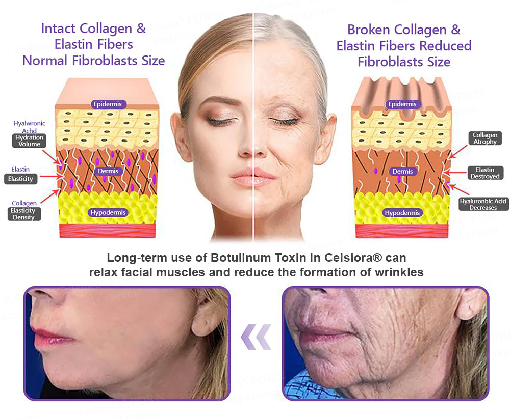 FDA Official: Celsiora® PDRN Multi-Peptide Massaging Body Roller Cream- Anti-aging, Hydrating, Skin Firming & Lifting, Skin Repair, Even Tone, Acne and Dark Spot Treatment, Wart and Mole Removal, and Psoriasis Relief.