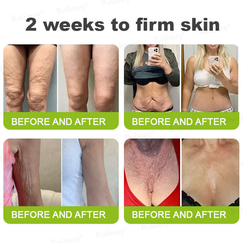 💫💧⭐Made and shipped from the USA 💫Rolimey® Botox & Vita-A Retinol Shot Wrinkle-Lift Tightening cream - Last Day Promotion 70% OFF