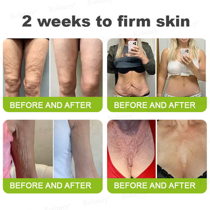 💫💧⭐Made and shipped from the USA 💫Rolimey® Botox & Vita-A Retinol Shot Wrinkle-Lift Tightening cream - Last Day Promotion 70% OFF