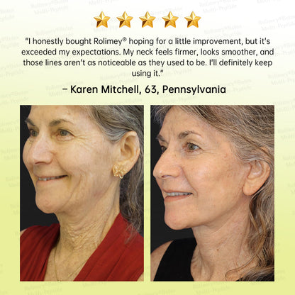 💐🌿🌟Rolimey® Multi-Peptide Retinol Shot Wrinkle-Lift Cream