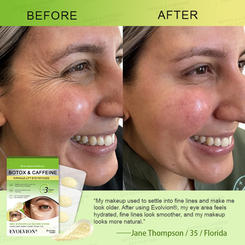 💗🪞✨USA HOT SALES ✨Evolvion® Botox & Caffeine Wrinkle-Lift Eye Patches