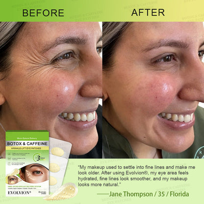 💗🪞✨USA HOT SALES ✨Evolvion® Botox & Caffeine Wrinkle-Lift Eye Patches