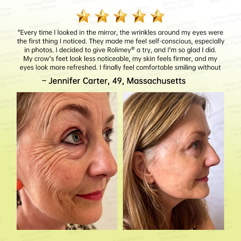 💐🌿🌟Rolimey® Multi-Peptide Retinol Shot Wrinkle-Lift Cream