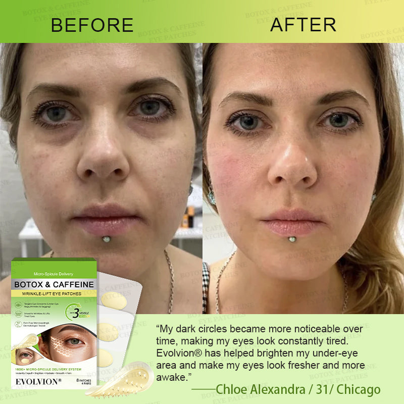 💗🪞✨USA HOT SALES ✨Evolvion® Botox & Caffeine Wrinkle-Lift Eye Patches