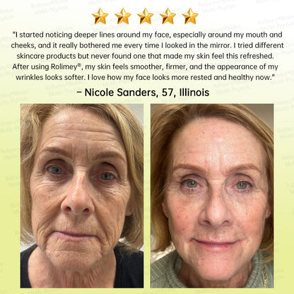 💐🌿🌟Rolimey® Multi-Peptide Retinol Shot Wrinkle-Lift Cream