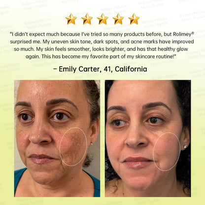 💐🌿🌟Rolimey® Multi-Peptide Retinol Shot Wrinkle-Lift Cream