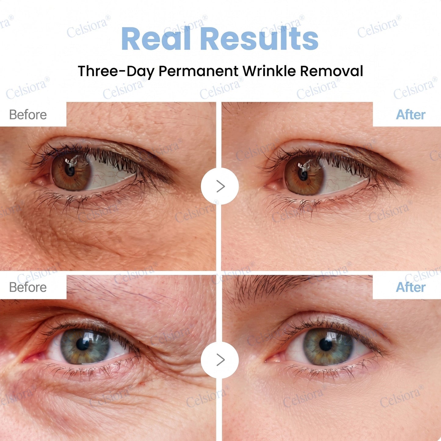 🥇Celsiora® PDRN Anti-Wrinkle Shot – Lift & Firming Cream