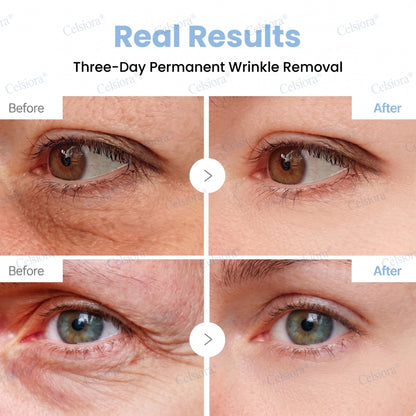 🥇Celsiora® PDRN Anti-Wrinkle Shot – Lift & Firming Cream