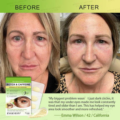 💗🪞✨USA HOT SALES ✨Evolvion® Botox & Caffeine Wrinkle-Lift Eye Patches
