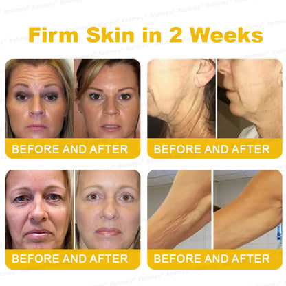 🌟Made and shipped from the USA 🌟Rolimey® Botox Stem Cell Retinol Wrinkle-Lift Cream - Visibly Lift & Smooth Neck and Chest Wrinkles