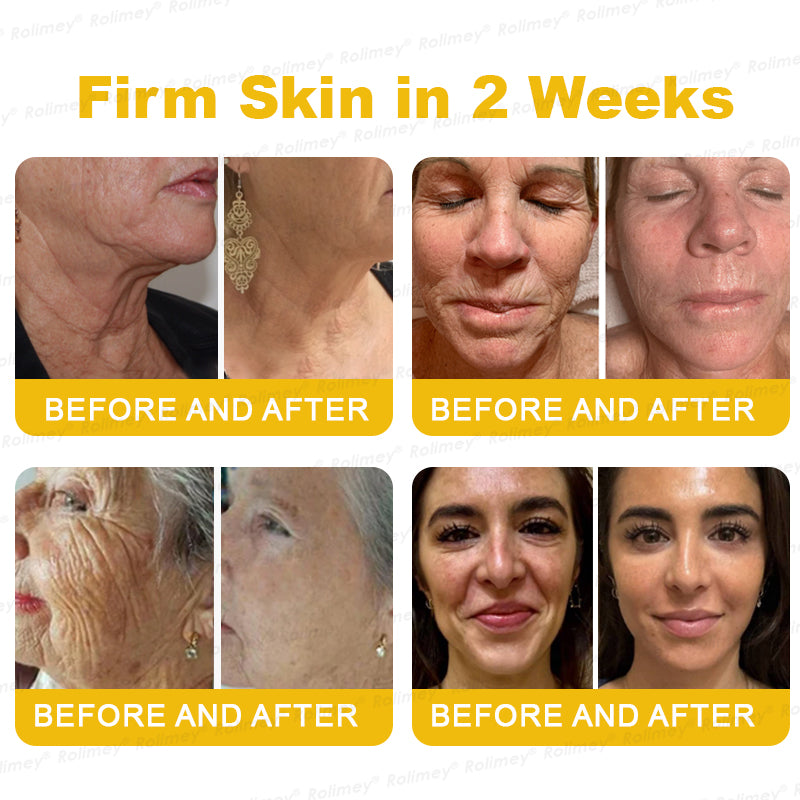 🌟Made and shipped from the USA 🌟Rolimey® Botox Stem Cell Retinol Wrinkle-Lift Cream - Visibly Lift & Smooth Neck and Chest Wrinkles
