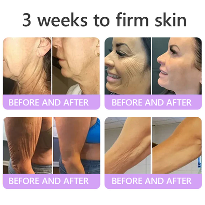 FDA Official: Celsiora® PDRN Multi-Peptide Massaging Body Roller Cream- Anti-aging, Hydrating, Skin Firming & Lifting, Skin Repair, Even Tone, Acne and Dark Spot Treatment, Wart and Mole Removal, and Psoriasis Relief.