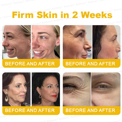 🌟Made and shipped from the USA 🌟Rolimey® Botox Stem Cell Retinol Wrinkle-Lift Cream - Visibly Lift & Smooth Neck and Chest Wrinkles