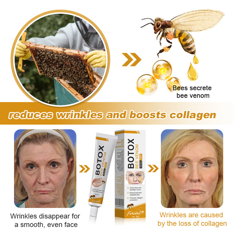 💅LAST DAY 70% OFF-Furzero™ Botox Bee Venom Wrinkle Removal Cream- FDA Approved