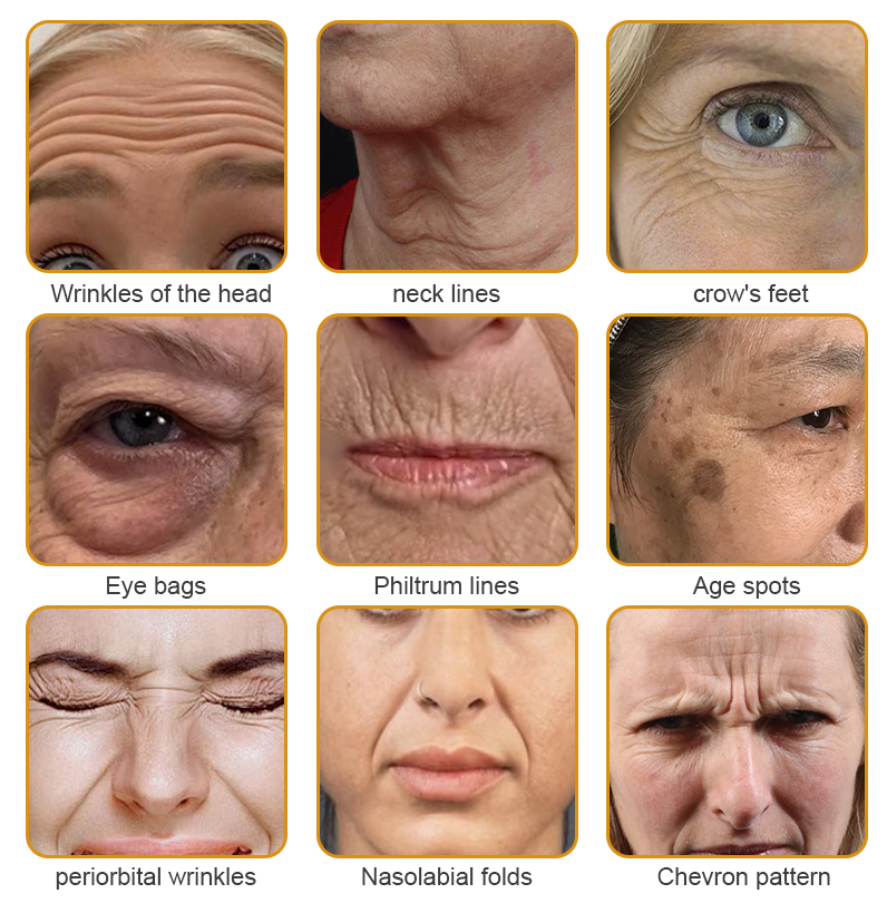 💅LAST DAY 70% OFF-Furzero™ Botox Bee Venom Wrinkle Removal Cream- FDA Approved