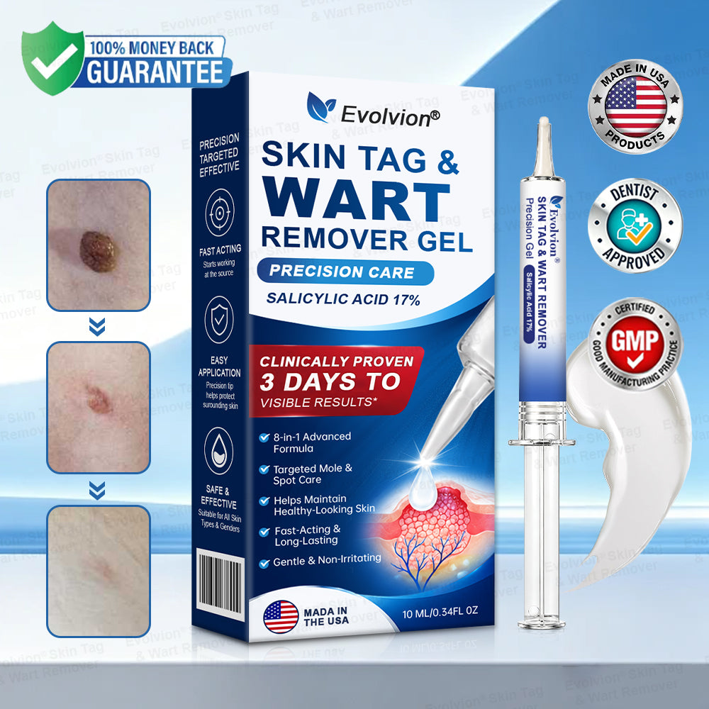 🌟🪄 BUY 1 GET 1 FREE🌟✨Evolvion® Skin Tag & Wart Remover Precision Gel- Last Day Promotion 70% OFF