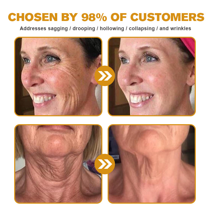 💅LAST DAY 70% OFF-Furzero™ Botox Bee Venom Wrinkle Removal Cream- FDA Approved