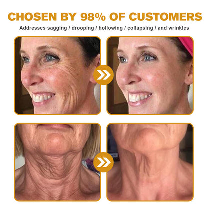 💅LAST DAY 70% OFF-Furzero™ Botox Bee Venom Wrinkle Removal Cream- FDA Approved
