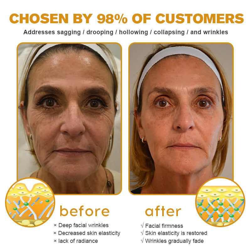 💅LAST DAY 70% OFF-Furzero™ Botox Bee Venom Wrinkle Removal Cream- FDA Approved