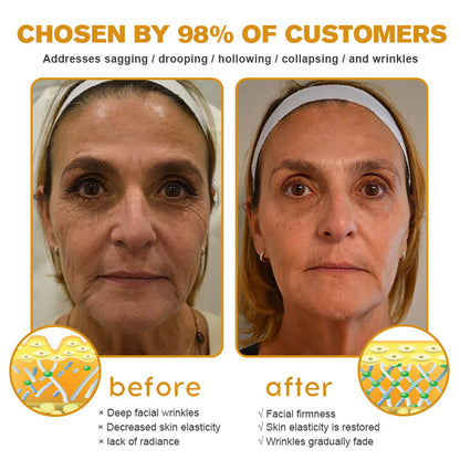 💅LAST DAY 70% OFF-Furzero™ Botox Bee Venom Wrinkle Removal Cream- FDA Approved